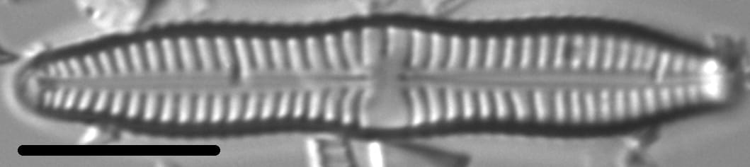 Gomphonema distans LM3