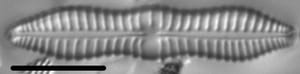 Gomphonema distans LM4