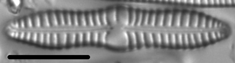Gomphonema distans LM5