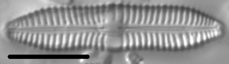Gomphonema distans LM7