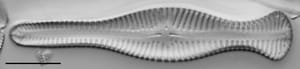 Gomphonema Truncatum 001