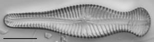 Gomphonema Truncatum 002