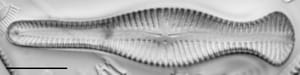 Gomphonema Truncatum 003
