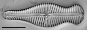 Gomphonema Truncatum 005