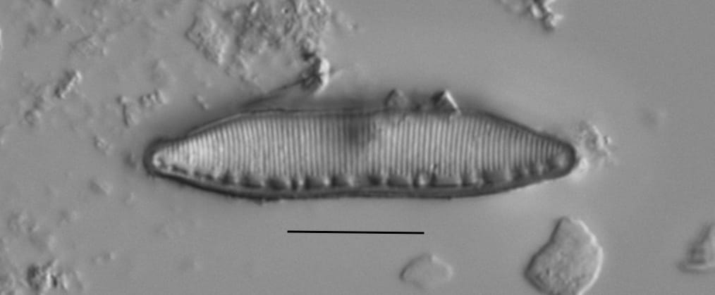 Haduplicate Amphioxys  Gc61088  002