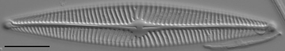 Navicula radiosa LM5