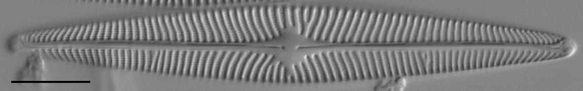 Navicula radiosa LM6