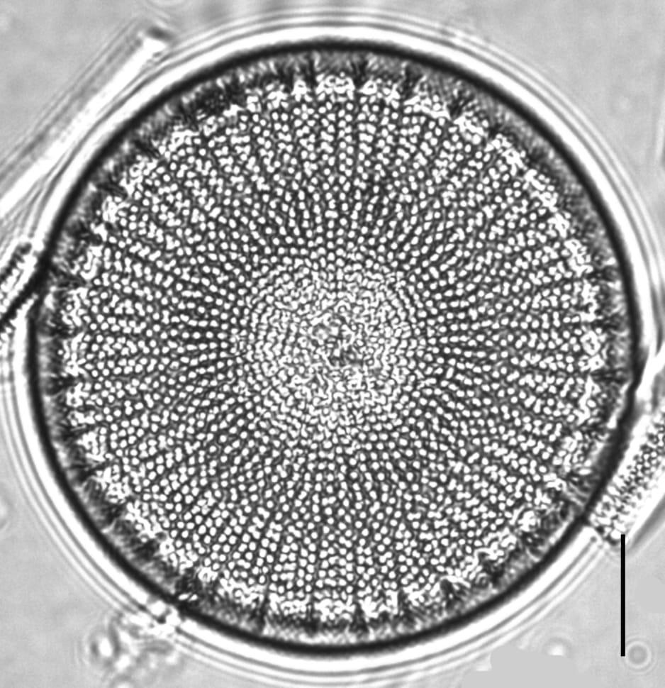 Ill2011 01 Robust Areolae