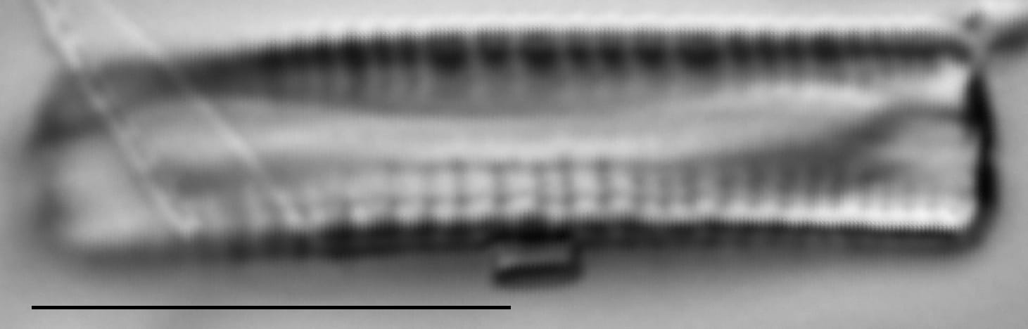 Fragilariforma bicapitata LM1