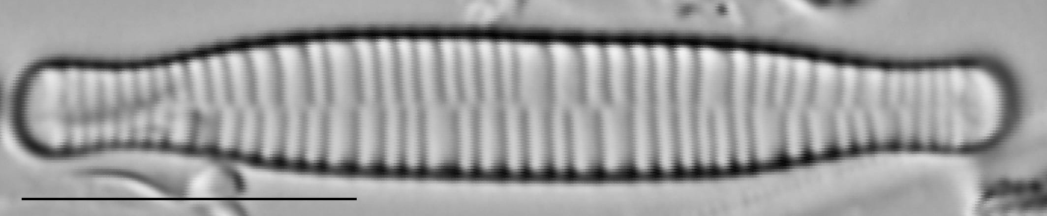 Fragilariforma bicapitata LM3
