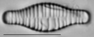 Fragilariforma bicapitata LM5