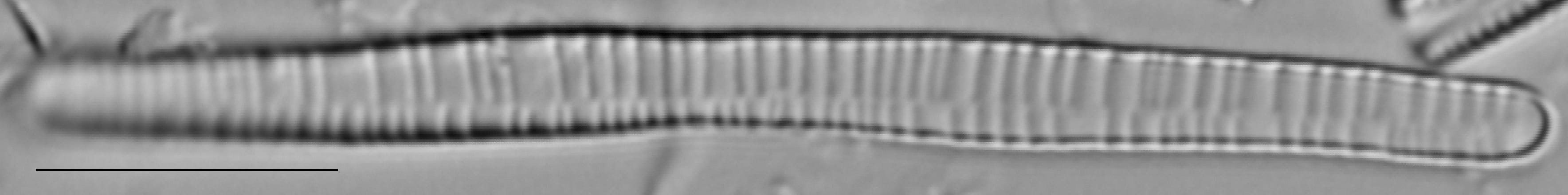 Fragilariforma bicapitata LM2