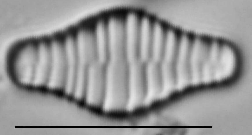 Fragilariforma bicapitata LM6