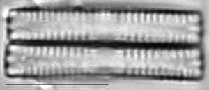 Fragilaria vaucheriae LM5