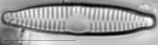 Fragilaria vaucheriae LM4