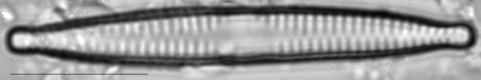 Fragilaria vaucheriae LM2