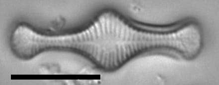 Kan2  Strain Iv  Cropped