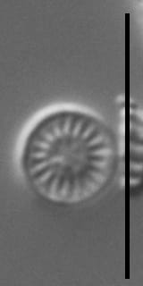 Discostella lacuskarluki LM5