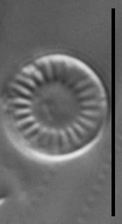 Discostella lacuskarluki LM1