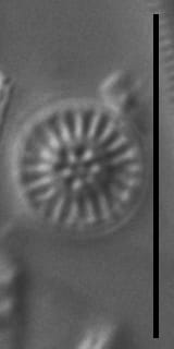 Discostella lacuskarluki LM2