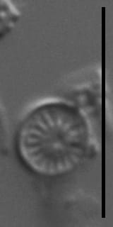 Discostella lacuskarluki LM7