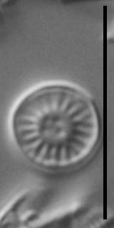 Discostella lacuskarluki LM3