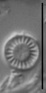 Discostella lacuskarluki LM4