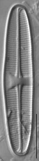 Lemnicola hungarica LM7