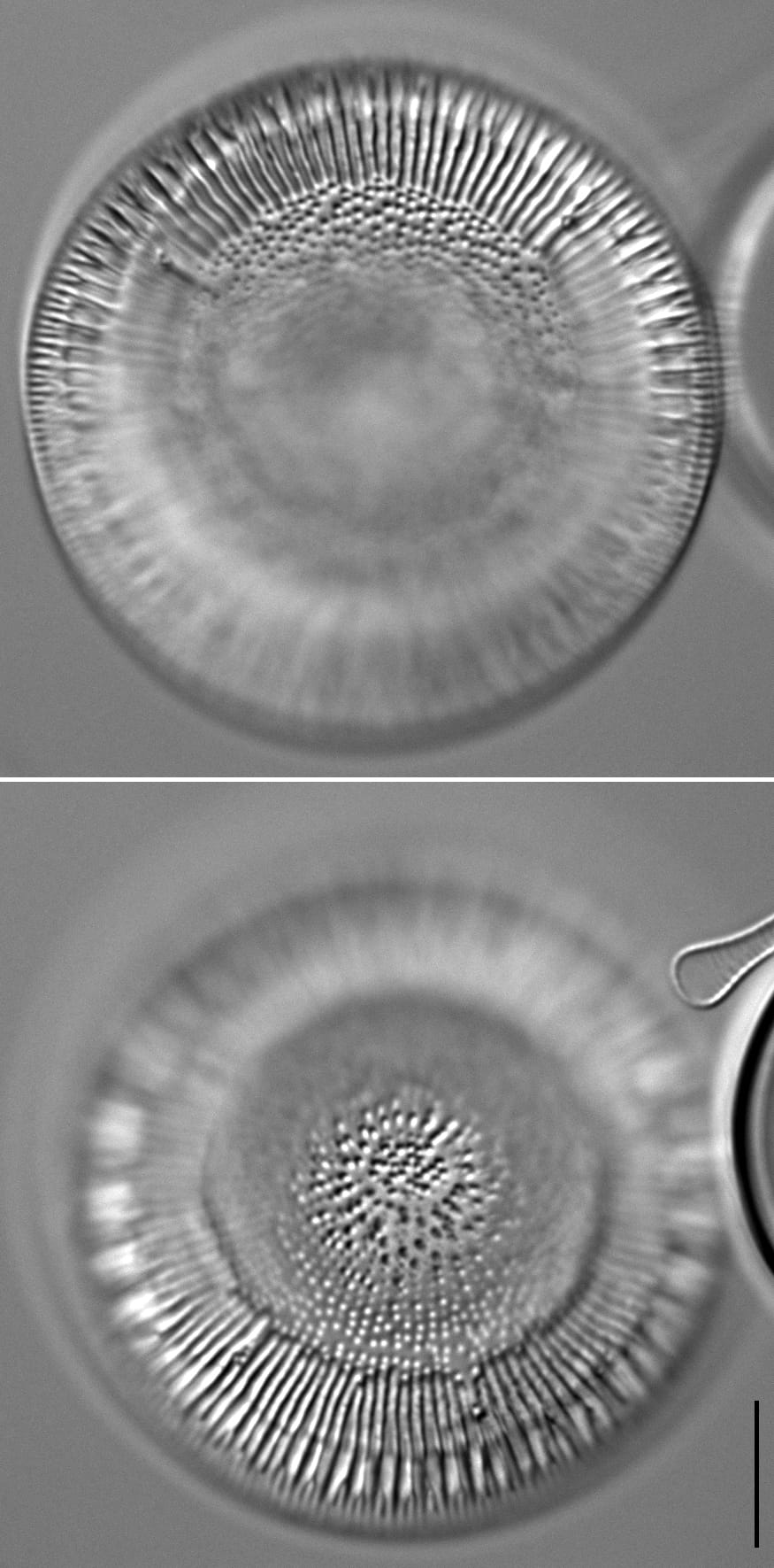 Lindavia eriensis LM6