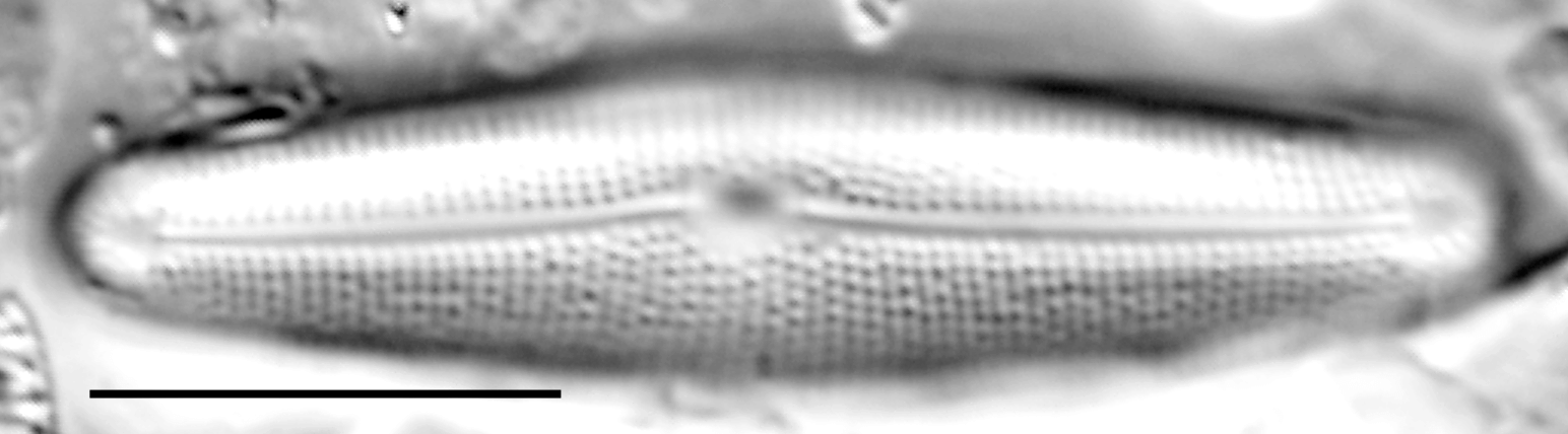 Frustulia creuzburgensis LM5