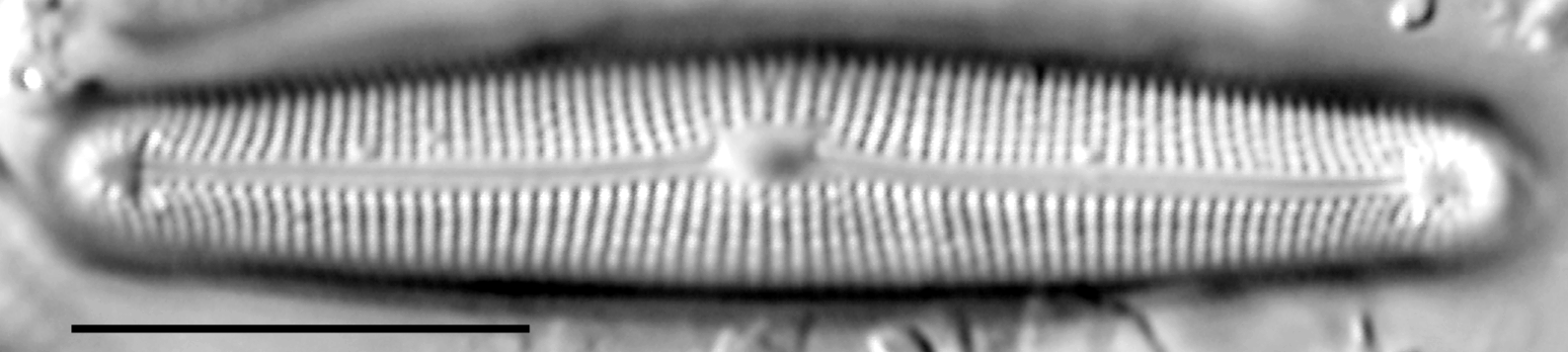 Frustulia creuzburgensis LM6