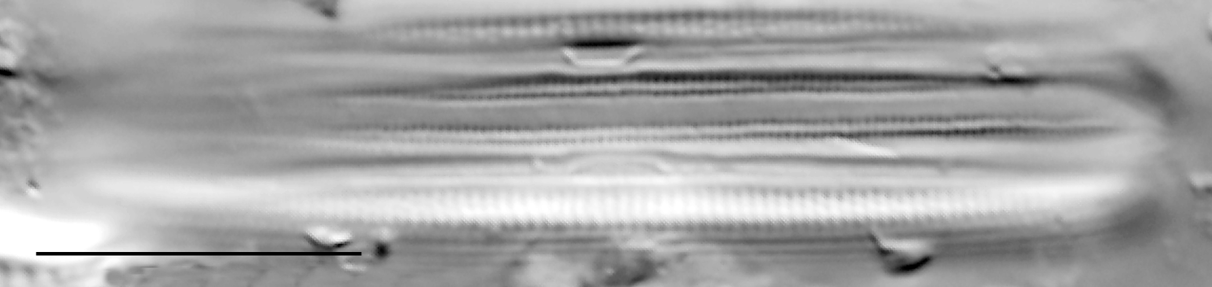 Frustulia creuzburgensis LM3