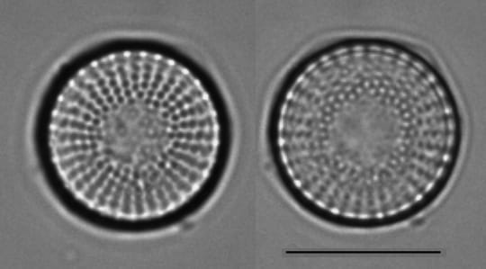 L  Ontario  Stephan Alpinus  Type 1 21A And B