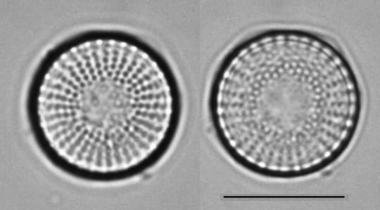L  Ontario  Stephan Alpinus  Type 1 21A And B 1
