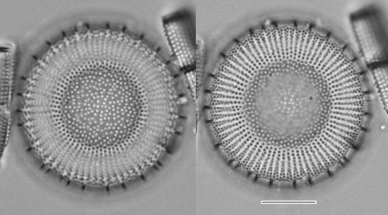 Lake  Erie  Er43  Stephanodiscus Alpinus  Ii  Iii 33 2