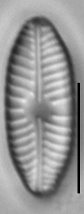 Placoneis paraelginensis LM4