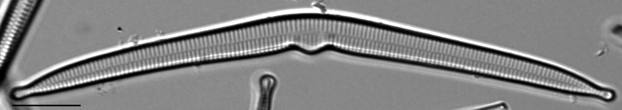 Hannaea superiorensis LM5