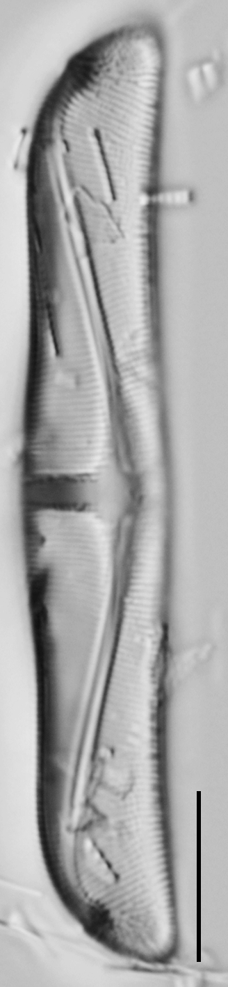 Amphora delphinea minor LM2