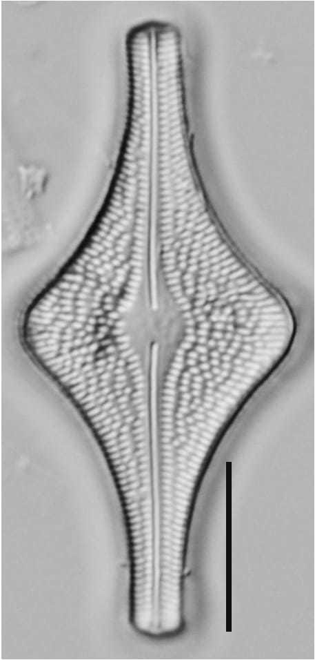 Brachysira follis LM6