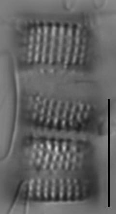 Aulacoseira nivalis LM1