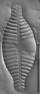 Planothidium dubium LM7