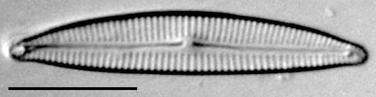 Encyonema evergladianum LM4