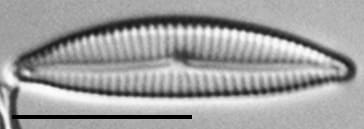 Encyonema evergladianum LM2