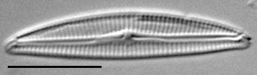Encyonema evergladianum LM1