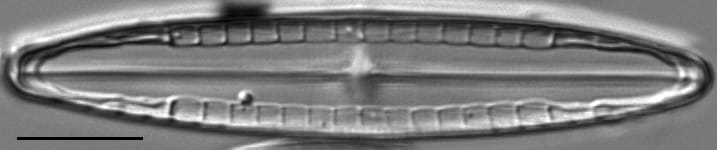 Mastogloia calcarea LM2