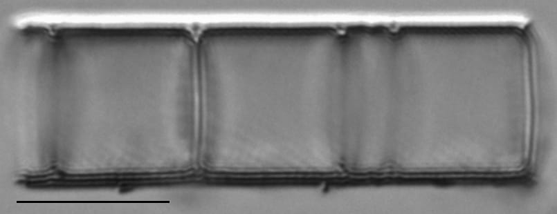 Aulacoseira ambigua LM5