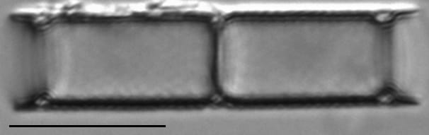 Aulacoseira ambigua LM7