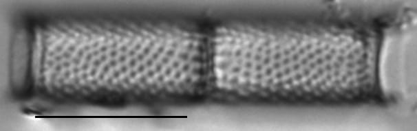 Aulacoseira ambigua LM1