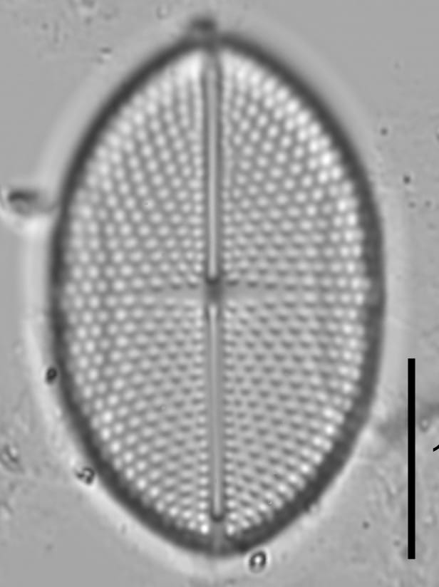 Mastogloia binotata LM7
