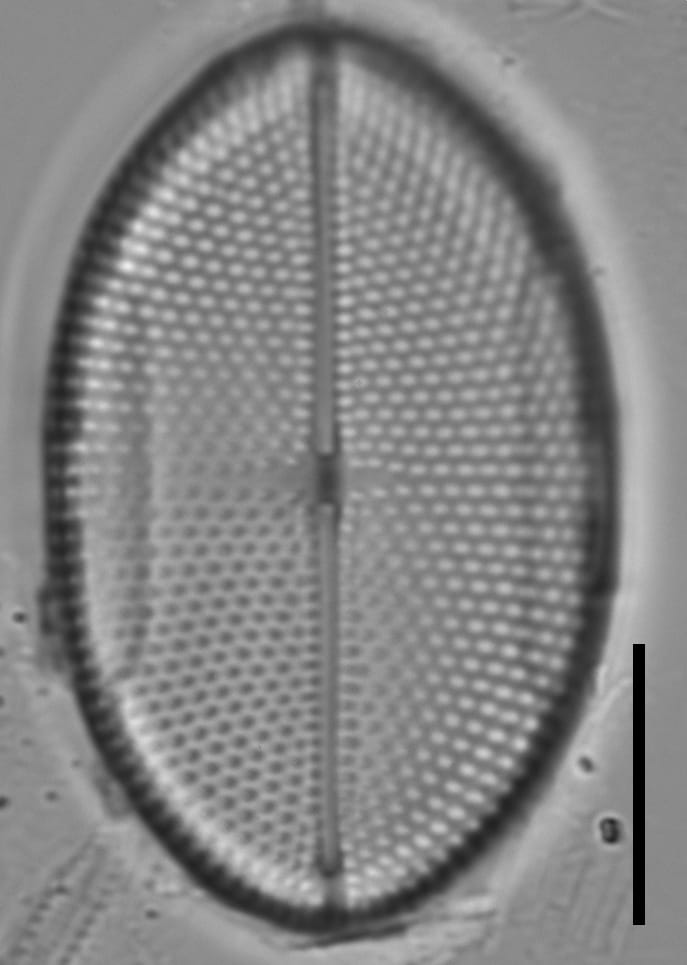 Mastogloia binotata LM1